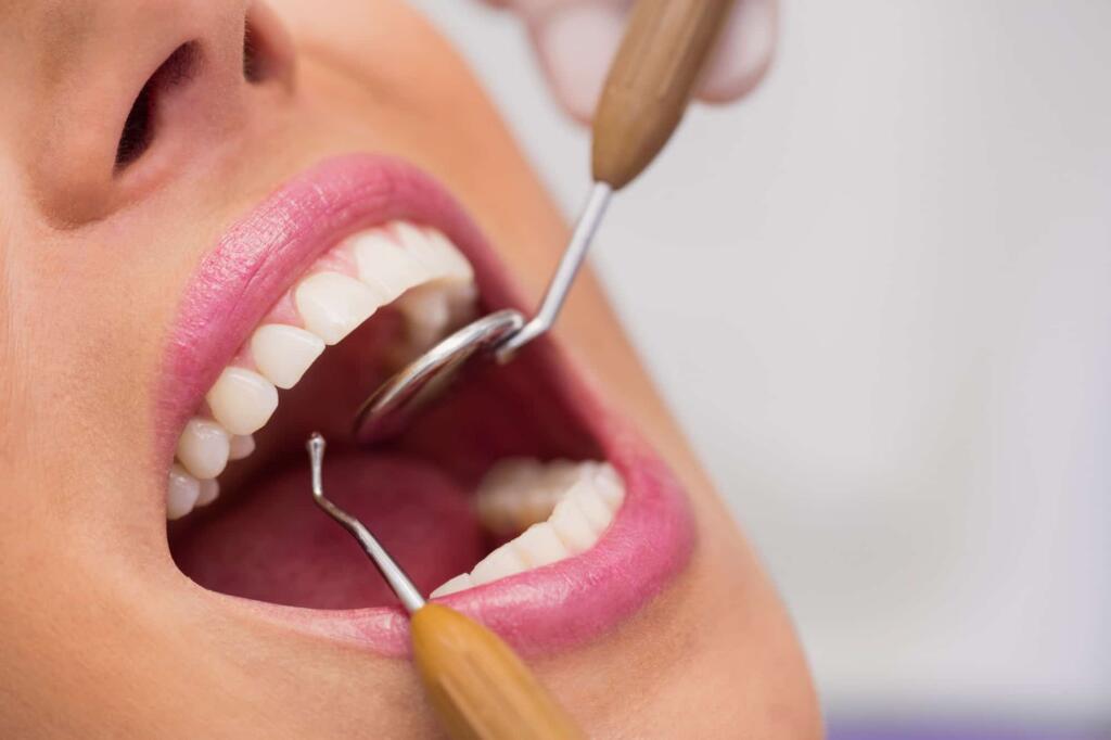Orçamento odontológico: o que pode influenciar no valor do tratamento?